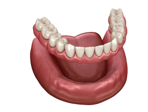 Was ist eine Prothese?